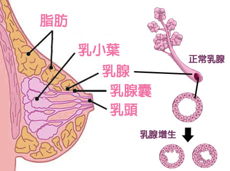 乳腺增生圖片